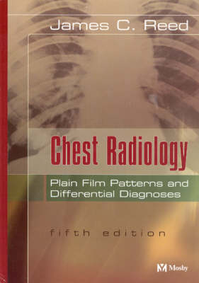 Chest Radiology