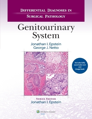Differential Diagnoses in Surgical Pathology: Genitourinary System - Jonathan I. Epstein, George J. Netto