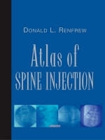 Atlas of Spine Injection - Donald Renfrew