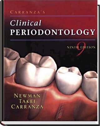 Carranzas Clinical Periodontology