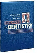 Implants in Dentistry