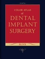 Color Atlas of Dental Implant Surgery