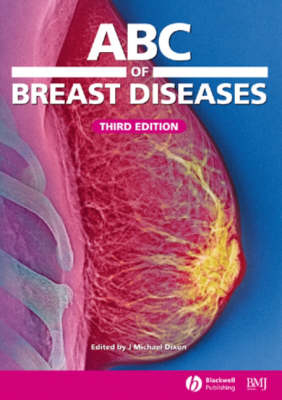 ABC of Breast Diseases - 