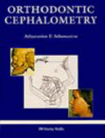 Orthodontic Cephalometry - 
