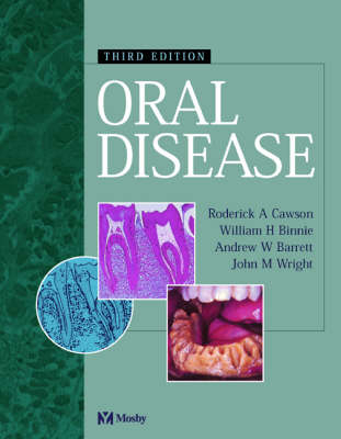 Oral Disease - J. W. Eveson, W.H. Binnie, Andrew W. Barrett, John M. Wright