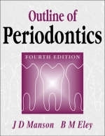 Outline of Periodontics