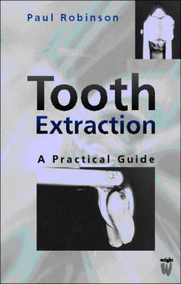 Tooth Extraction - Paul D. Robinson