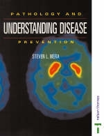 Understanding Disease
