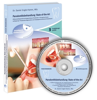 Parodontitisbehandlung State-of-the-Art