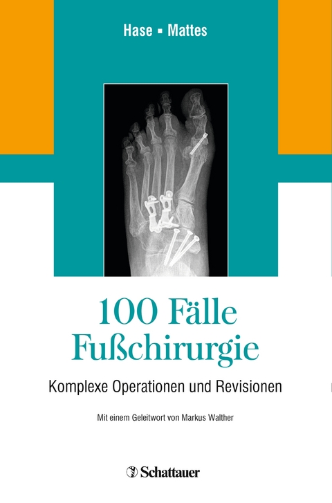 100 F&auml;lle Fu&szlig;chirurgie - 