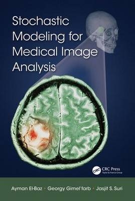 Stochastic Modeling for Medical Image Analysis -  Ayman El-Baz,  Georgy Gimel'farb,  Jasjit S. Suri