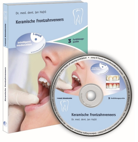 Keramische Frontzahnveneers - Dr. med. dent. Hajt&oacute;  Jan