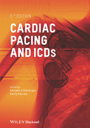 Cardiac Pacing and ICDs - 