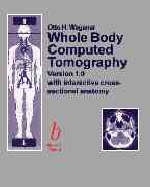 Whole Body Computed Tomography