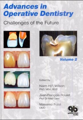 Advances in Operative Dentistry