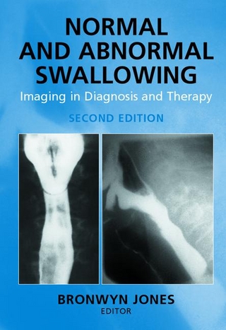 Normal and Abnormal Swallowing
