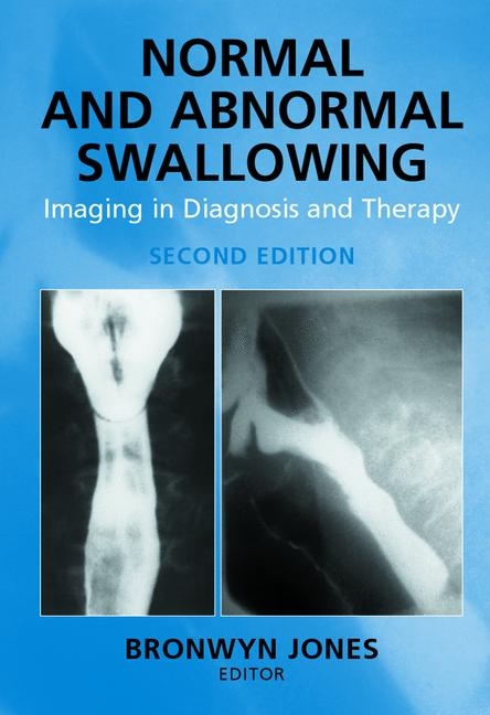 Normal and Abnormal Swallowing - 