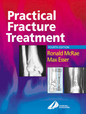 Practical Fracture Treatment - Ronald McRae, Max Esser