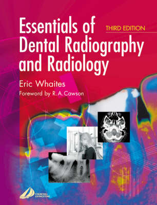 Essentials of Dental Radiography and Radiology