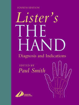 Lister's the Hand