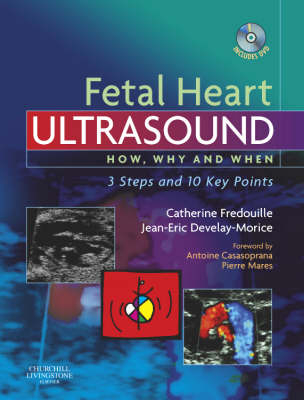Fetal Heart Ultrasound - Catherine Fredouille, Jean-Eric Develay-Morice