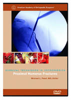 Proximal Humerus Fractures - 