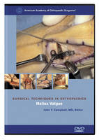 Surgical Techniques in Orthopaedics - 