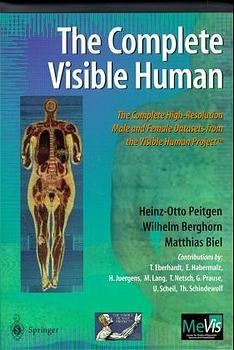 The Complete Visible Human