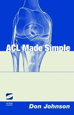 ACL Made Simple