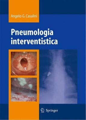 Pneumologia Interventistica