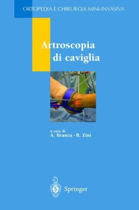 Artroscopia Di Caviglia - R Zini, A Branca