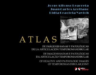 Atlas