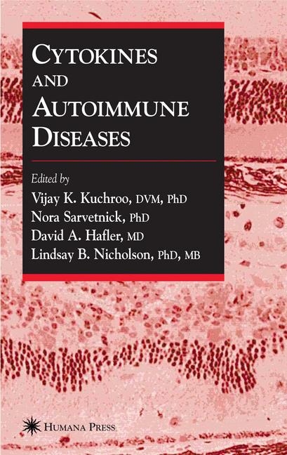 Cytokines and Autoimmune Diseases - 