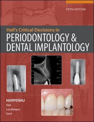 Hall’s Critical Decisions in Periodontology