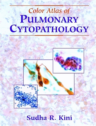 Color Atlas of Pulmonary Cytopathology