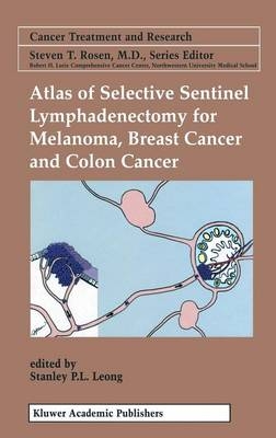 Atlas of Selective Sentinel Lymphadenectomy for Melanoma, Breast Cancer and Colon Cancer