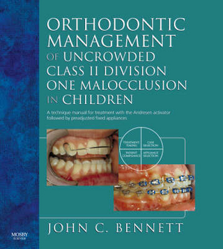 Orthodontic Management of Uncrowded Class II Division One Malocclusion in Children