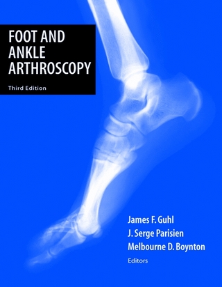 Foot and Ankle Arthroscopy