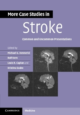 More Case Studies in Stroke