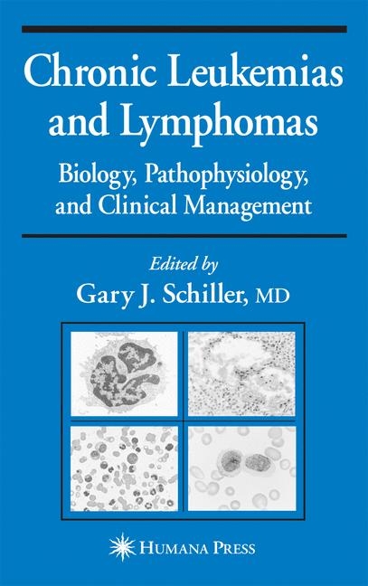 Chronic Leukemias and Lymphomas - 