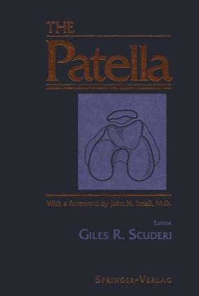 Patella