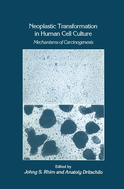 Neoplastic Transformation in Human Cell Culture -  Anatoly Dritschilo,  Johng S. Rhim