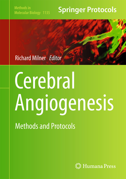 Cerebral Angiogenesis - 