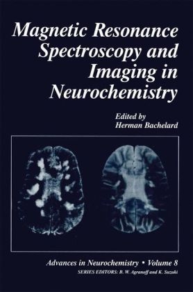 Magnetic Resonance Spectroscopy and Imaging in Neurochemistry - 