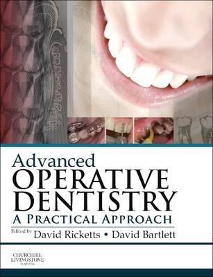 Advanced Operative Dentistry