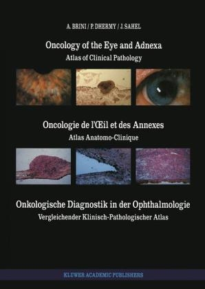 Oncology of the Eye and Adnexa / Oncologie de l' il et des Annexes / Onkologische Diagnostik in der Ophthalmologie