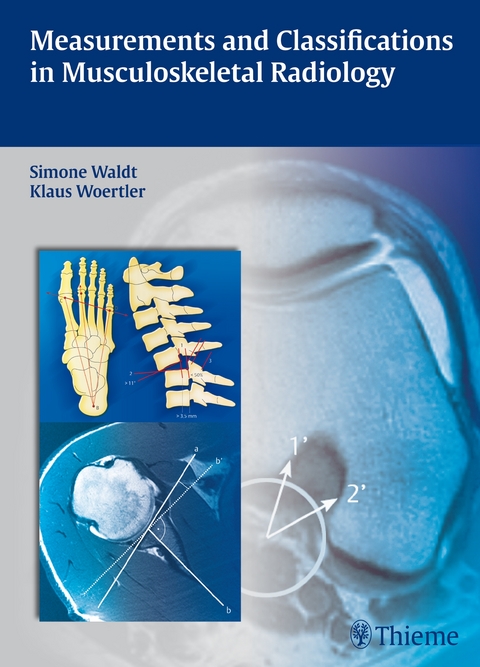Measurements and Classifications in Musculoskeletal Radiology - Simone Waldt, Klaus W&ouml;rtler
