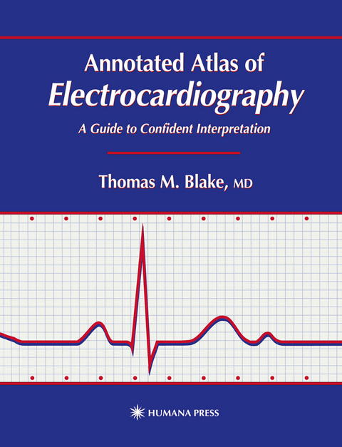 Annotated Atlas of Electrocardiography - Thomas M. Blake