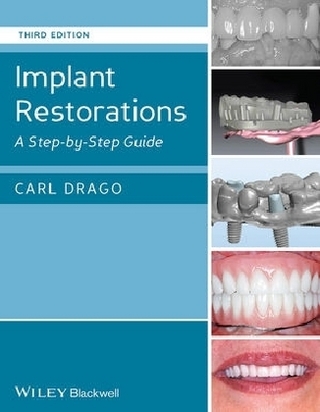 Implant Restorations