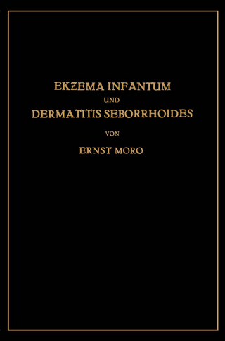 Ekzema Infantum und Dermatitis Seborrhoides